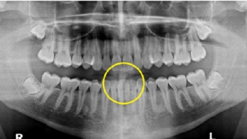 米大生「歯がズレて拷問死」めぐり米議会が金正恩に反撃