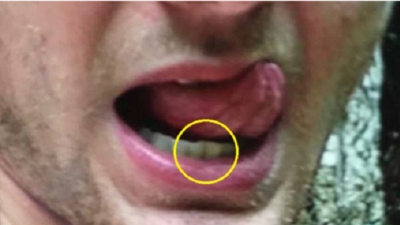 米大学生の「歯がズレて拷問死」が金正恩氏を苦しめ続ける